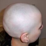 Profile picture of BaldSmoothLover